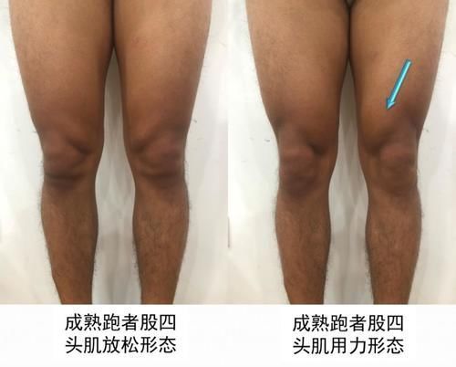 训练|坚持跑步给你留下训练痕迹了吗？跑者的十大形态特征