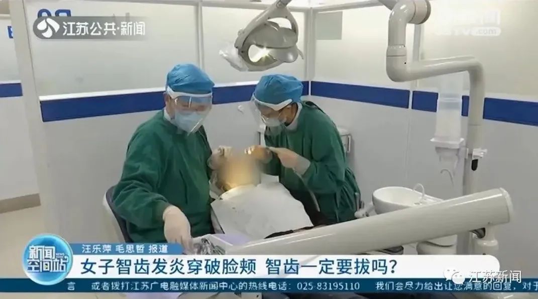 扬州大学|可怕！智齿反复发炎，女子脸颊竟烂穿一个洞！