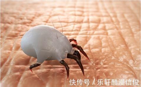 不用暴晒,不用开水,只需一个小妙招,床上细菌螨虫会少很多