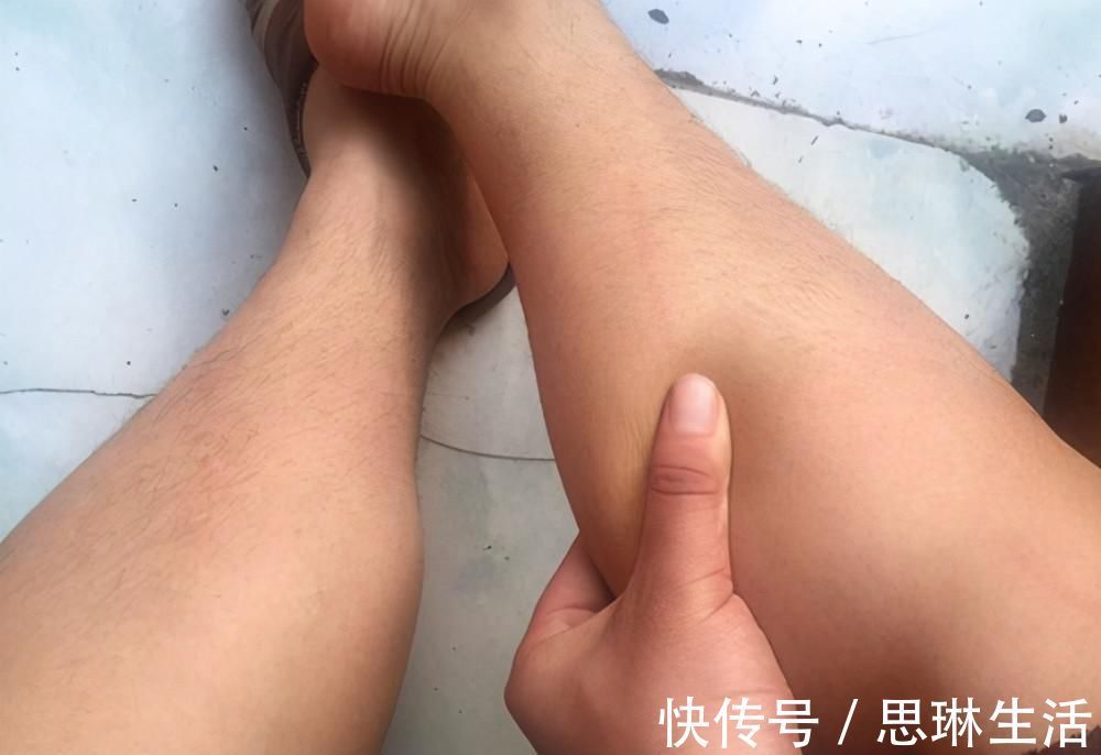 亚油酸|血栓的“清道夫”找到了，大蒜排第三排，排首位的很多人都不知道