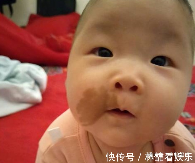 化学物质|越来越多胎儿被“胎记”缠身,若不想孩子自卑,孕妈要管住自己