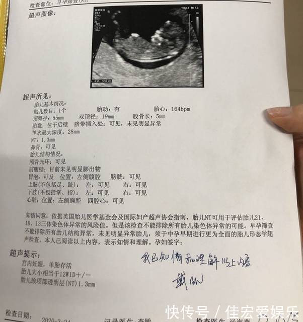 nt|nt单子上有男女标志是真的吗