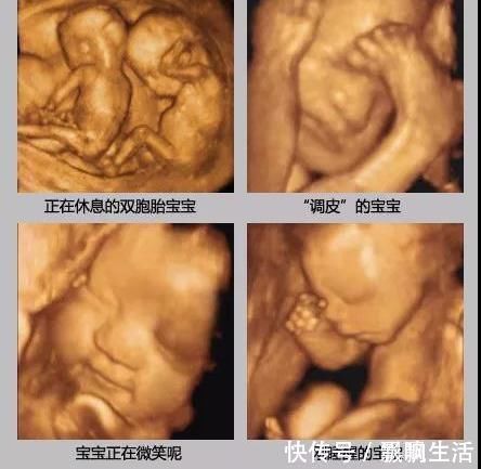 孕期|胎儿性格隔着肚皮能看出来吗?孕期欢脱的胎儿,出生后也多调皮