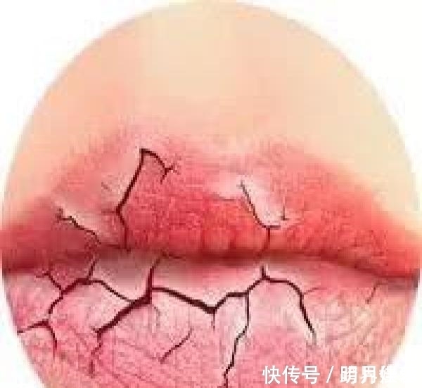 若嘴唇有这6个症状,说明身体出现了问题,看看