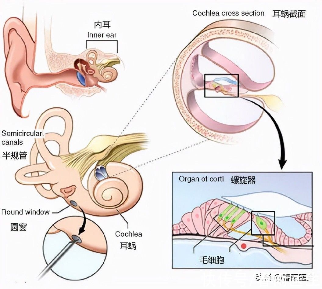 耵聍栓塞|天天掏耳朵觉得很“干净”？掏成耳鸣就后悔去吧