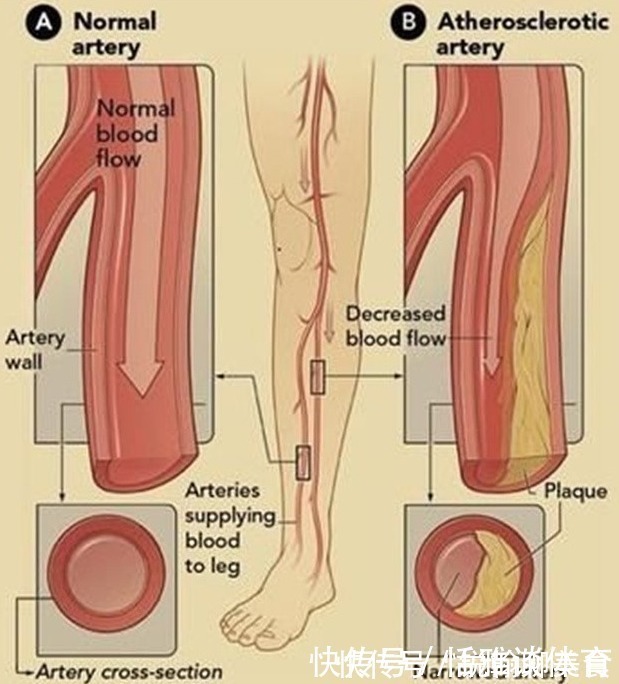 组织细胞|怎么知道“血管堵没堵”?教您几个方法,轻松解决,很实用