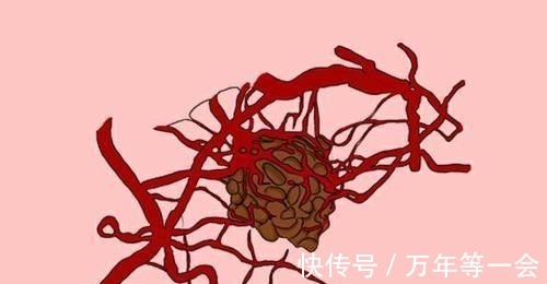 治疗|癌细胞明明扩散了,可患者的食欲没减退,精神也不错,是为什么?