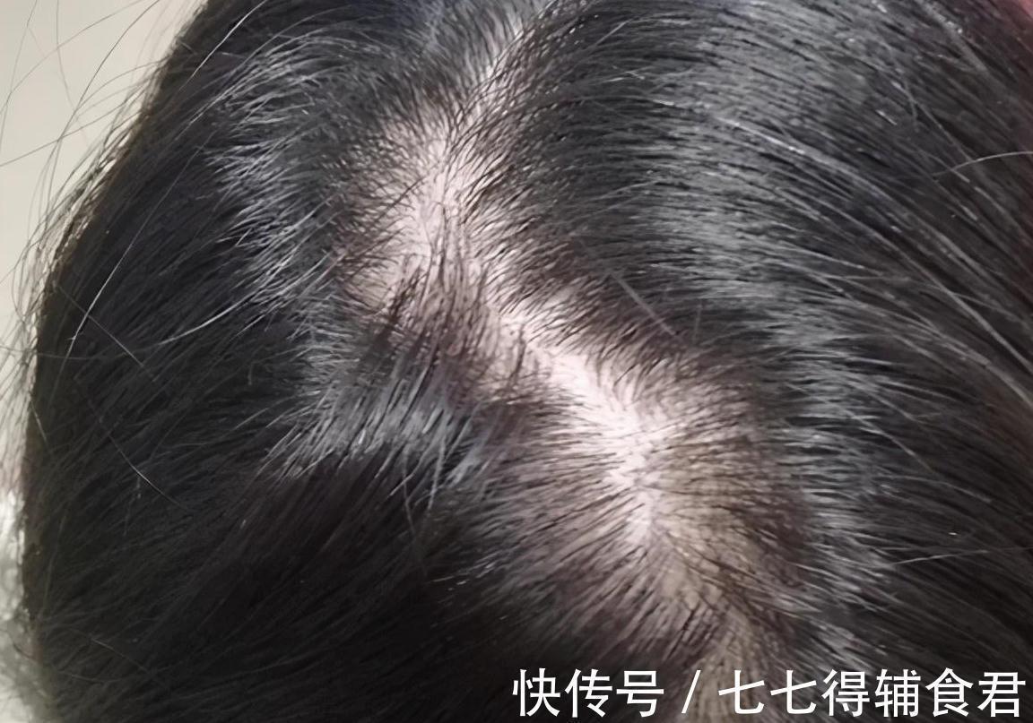 老一辈|孕期剪头发,会剪断宝宝的福气?妈妈别担心了,看看正确解释