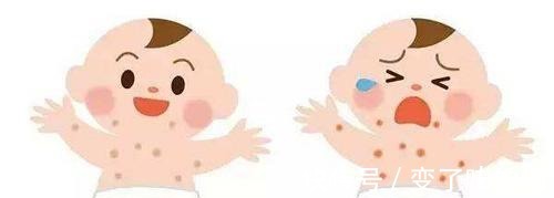 疫苗|宝宝起湿疹期间能不能打疫苗 宝宝有湿疹为什么不能打预防针接种疫苗!