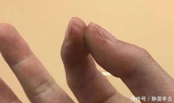 手指被502胶水粘住了别着急只需要泡一泡,胶水立马融化