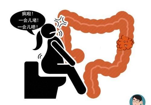  里急后重|肠道有癌，排便先知！医生提醒：排便出现4种异常，尽早检查