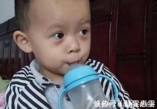 父母|5岁男童长期积食不在意,拖成“疳积”,医生:家长太无知了