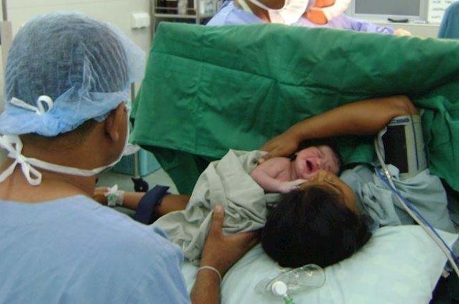 顺产|顺产时的“侧切”,对以后的生活会不会有影响看看医生怎么说