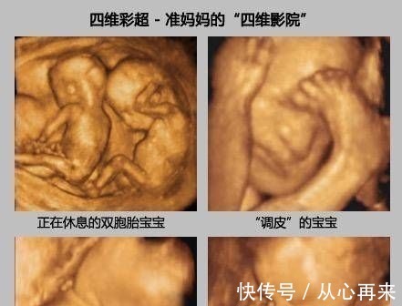 小茹|为什么有些医院做四维彩超不让家属陪同这些原因,大家有权知道