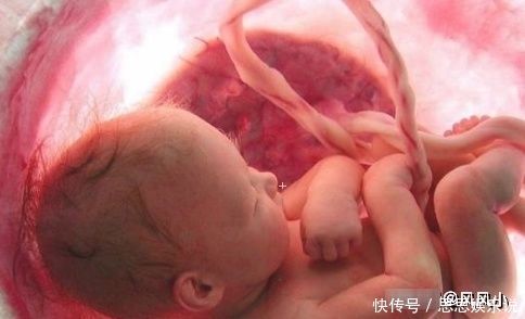 脐带|胎儿“脐带绕颈”？多数和3个生活习惯有关，孕妈尽量注意下！