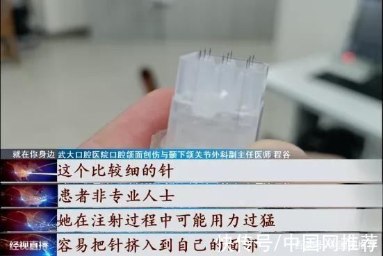 脸部|警惕!女子为省钱自己在家美容，不料针头断裂扎进脸部