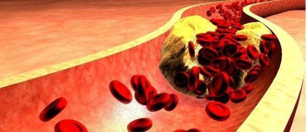 阿司匹林|长期服用阿司匹林,血液会变稀、血管会变薄?看完可能就清楚了!