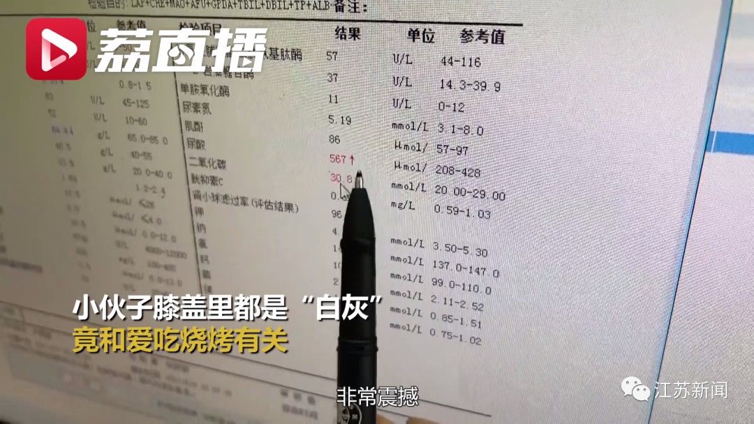 小伙|吃了顿烧烤，小伙路都走不了了！医生惊了：膝盖里全是“白灰”