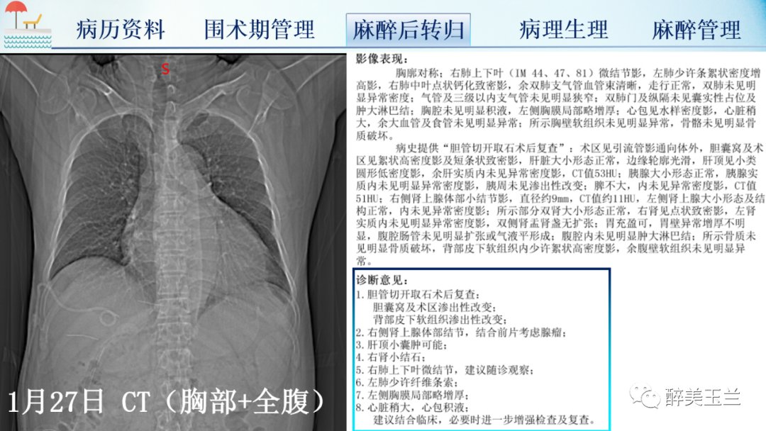 扩张型心肌病患者非心脏手术的全身麻醉一例|病例讨论 | 全身麻醉