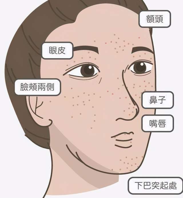 肝脏|肝脏不好的人,会出现2处黑,2处红,一个不占,说明肝比较健康