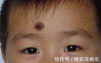 马虎|避免宝宝出生长胎记，怀孕期间一定要记住3件事，别马虎大意