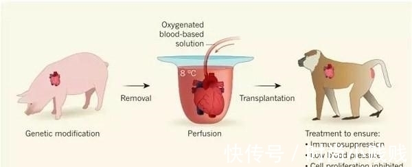 贝利|80年代，美国一女婴为保命，移植了一颗狒狒心脏，最终结局怎样？