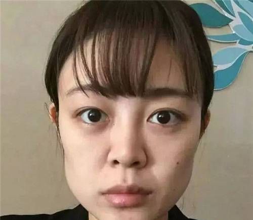 3种被公认为“不忍直视”的脸型，神仙整容术也拯救不了你的颜值