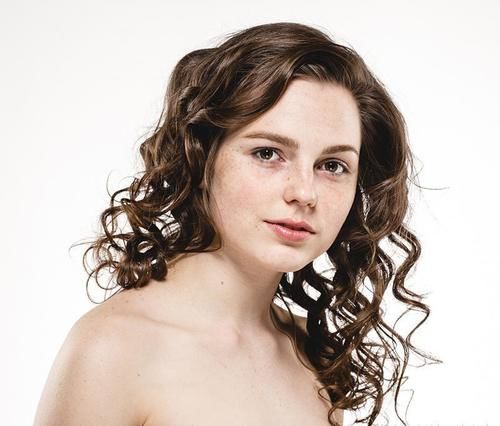 什么？！斑有很多种？先要搞懂斑再来谈除斑