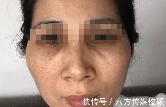 营养物质|29岁宝妈,产后变黄脸婆,医生叹气:这3事做错了,需及时改正