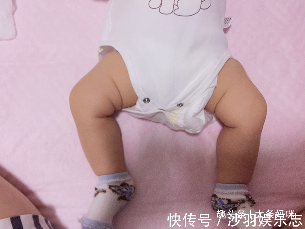 腿纹|腿部可以看出健康问题,宝宝双腿出现3种情况,妈妈不能小觑
