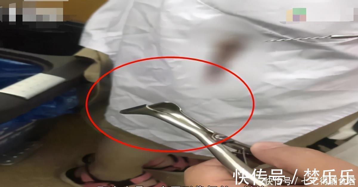 下体|3岁女孩裤子发臭,妈妈崩溃:这些东西是怎么跑进孩子身体里的?