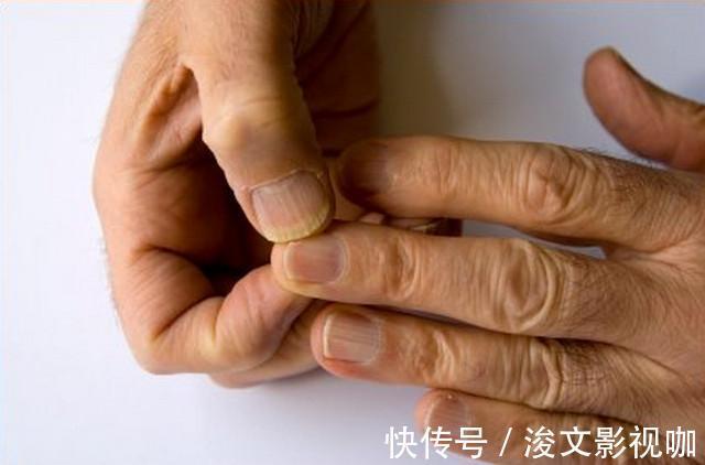 竖棱|肾不好的人, 手上3个表现“出卖你”, 很容易看出来