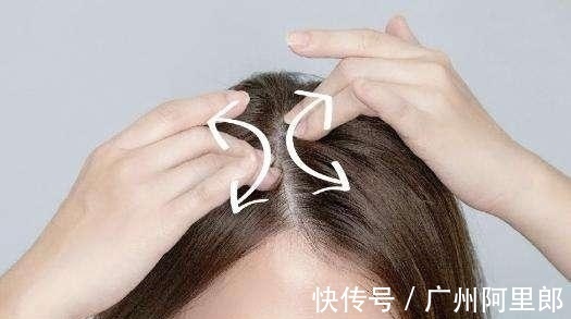 柠檬水|头皮油、头发掉得快,原来是因为它!