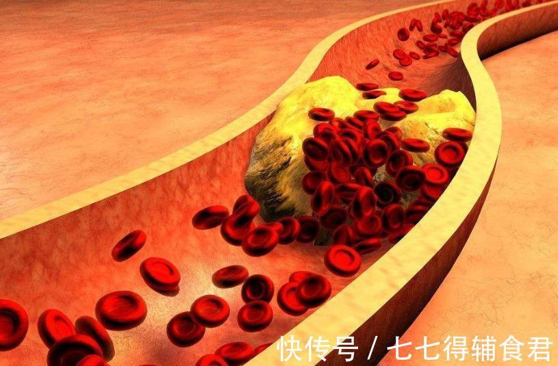 紫菜|多走路能降血脂?医生建议:日常多吃这4物,或比走路效果好