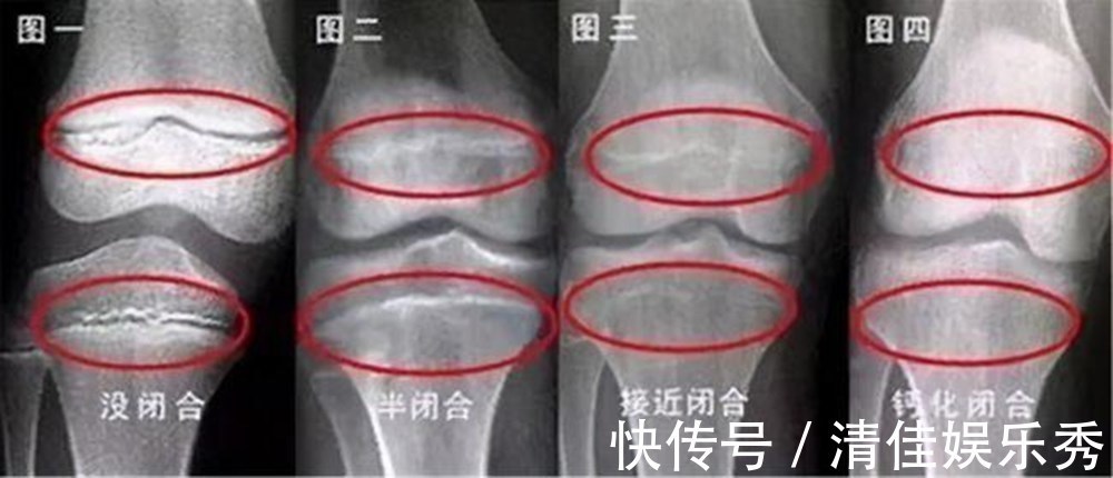 男孩儿|当男孩出现这些特征,暗示到了长高“天花板”,和年龄关系不大