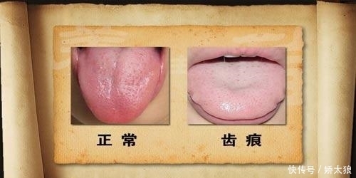 張錫純健脾方幫你改善脾虛,還有四神豆漿,同補五臟!