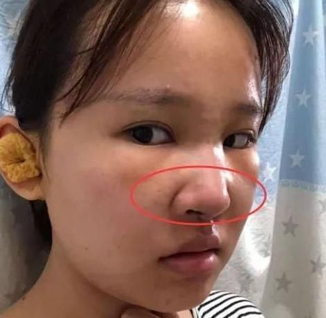 青春期女生“贼伤鼻子”的3行为,难怪没人爱,原来是鼻子在作怪