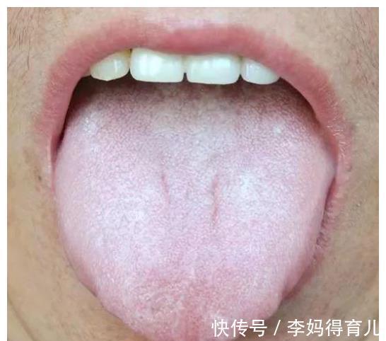 湿热|怎么样才算是脾虚？脾虚到底是怎么回事？