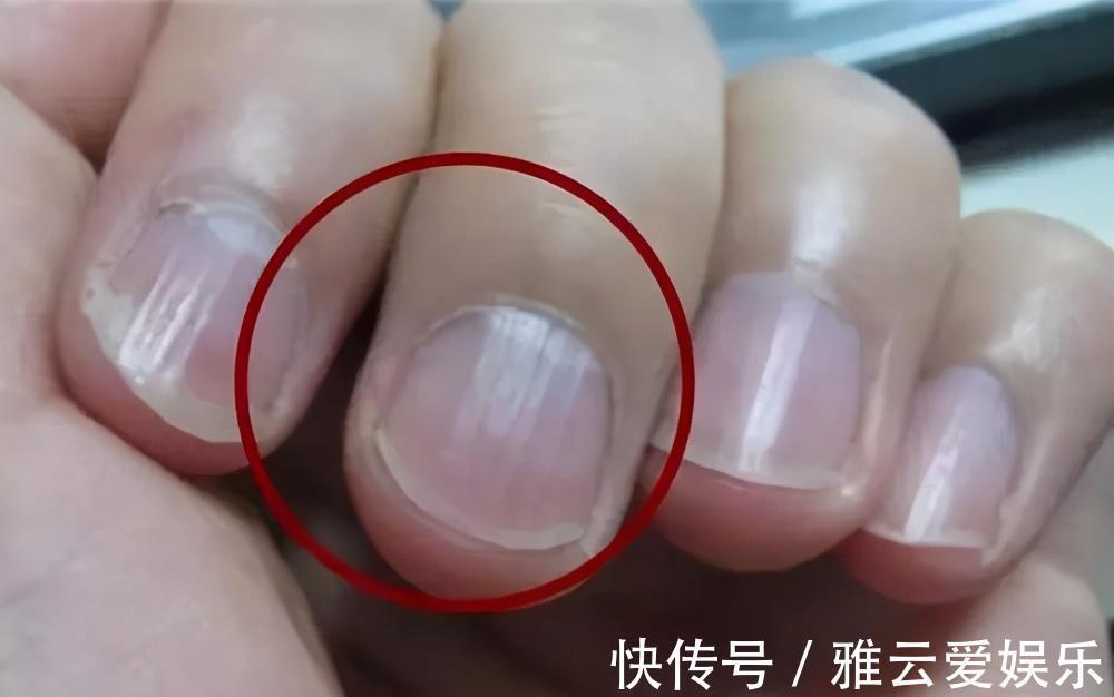 脸色苍白|气血不足怎么判断身体若出现7个信号，说明该补气血了