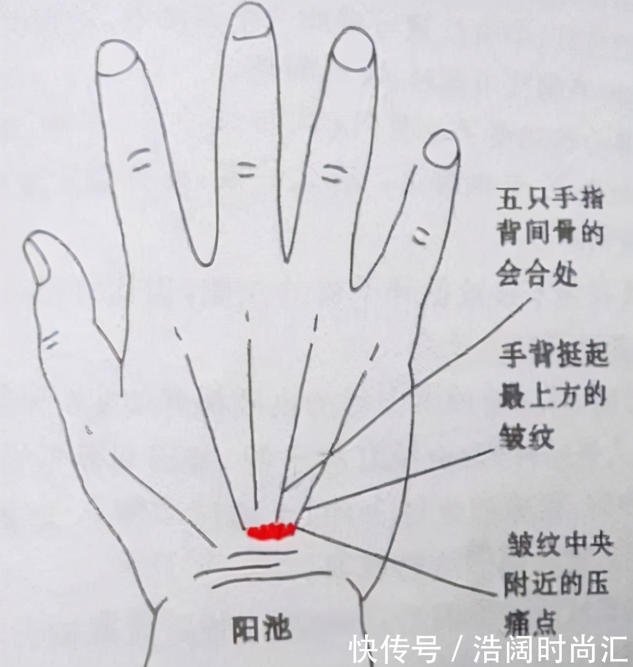 奶汁草|血糖高的人,身体有4个表现,若一个都没有,血糖还算稳定