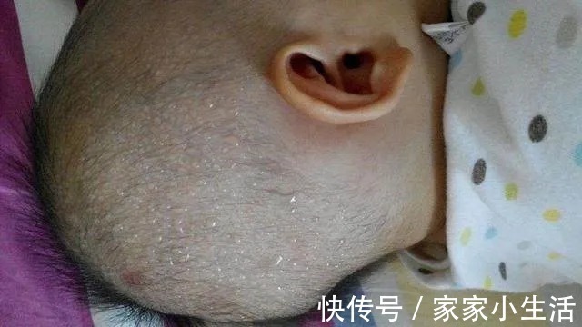 散热|【家家母婴】宝宝睡觉时总是满头大汗,是缺钙还是生病了?