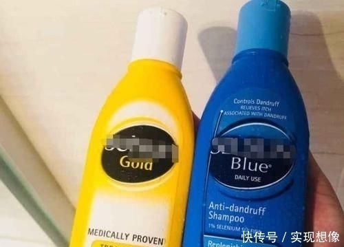 冬天头皮屑过多，是源于这4种坏习惯，若能改善头发清爽又干净