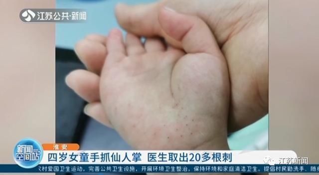 小熊掌|3岁女童一掌拍在仙人球上,家人处理方式让她的手肿成“小熊掌”