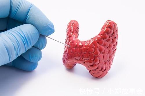 清淡饮食|为什么清淡饮食血脂还高呢?医生:或是“四大原因”所致