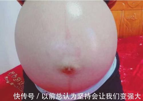 孕妇|孕妈一般在什么时候开始“显怀”?若显怀过早,可能是这几个原因