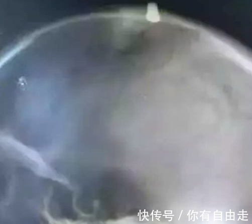 马拉松|脑袋被子弹击中,他误认是石子,坚持跑完52里,不料竟有意外收获