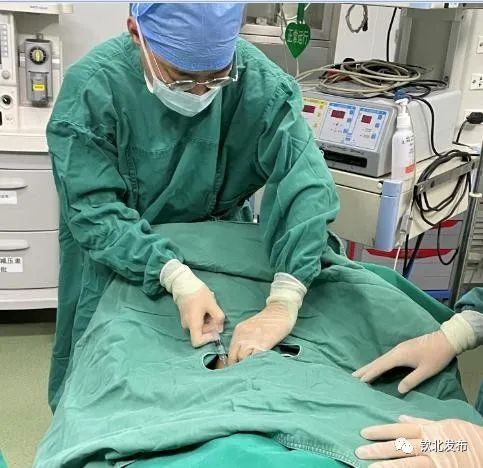 透析|突破！钦州市钦北区人民医院完成首例半永久血透导管置入术