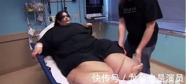 减肥成功|女子减肥成功,一年减200多斤,结果看到自己的皮肤,不淡定了