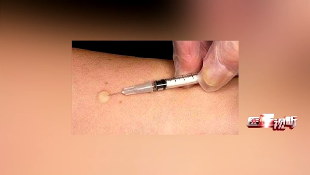 阴性|青霉素皮试不过敏,就一定不会过敏吗?