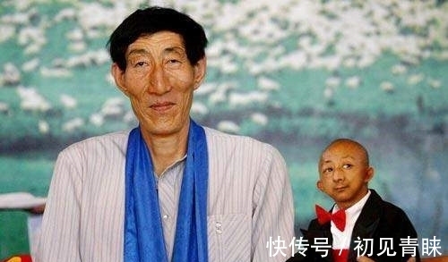 侏儒症|中国巨人鲍喜顺:12年前不顾医生忠告执意生下一子,现在怎样